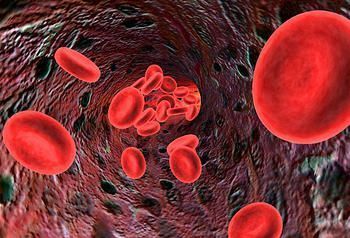 anemia-ferropenica-carencia-hierro
