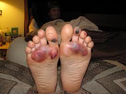 barefoot ko